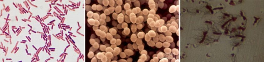 Az E. coli, a széklet enterococcus és a proteus a krónikus bakteriális prosztatagyulladás fő okozói