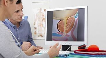 a prosztatagyulladás diagnosztizálása férfiban
